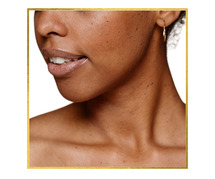 Neck Lift Treatment in Los Angeles