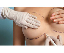Benefits of Breast Reconstruction After Fighting Cancer