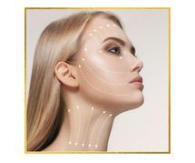 PDO Thread Lift in Los Angeles
