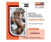 best advanced acne laser treatment in india