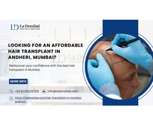 Looking for an affordable hair transplant in Andheri, Mumbai?