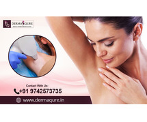Permanent Laser Hair Removal in Bangalore