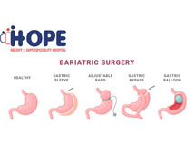 Life After Bariatric Surgery: Embrace the Change for a Healthier You