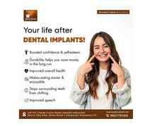 Dental Implant Doctor in Indirapuram