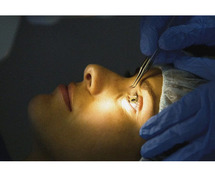 How Much Does Laser Eye Treatment Cost?