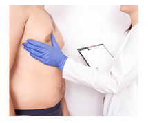 Gynecomastia Surgery in Delhi by Dr. Lokesh Handa