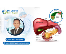 Best Gall Bladder Surgeon in Sarjapur Road