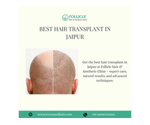 Best hair transplant in jaipur