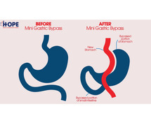 Transform Your Health: A Smarter Solution for Diabetes & PCOS