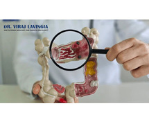 Expert Role of a Medical Oncologist in Colorectal Cancer Care